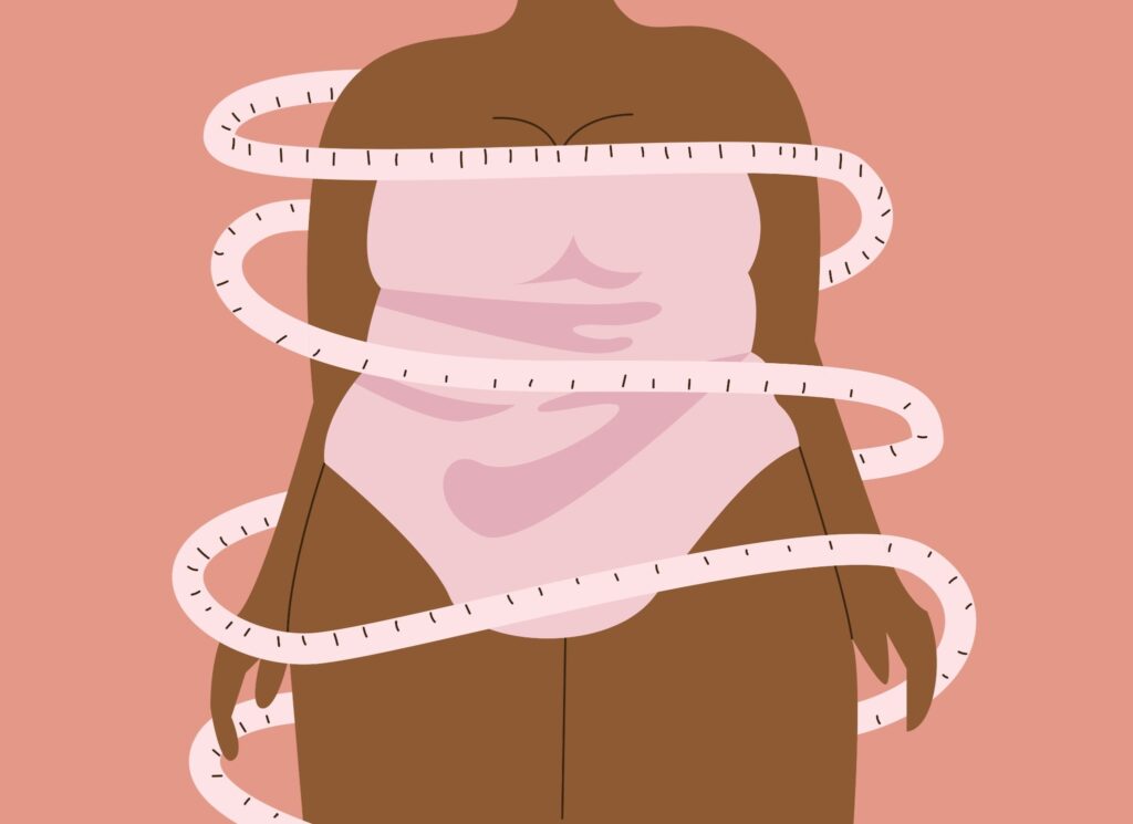 kvinde med overvægt i medicinsk vægttabsbehandling